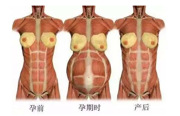 產(chǎn)后媽媽骨盆修復――帶你回到完美身材！