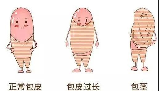 【保山安利醫(yī)院】家長速看！暑期包皮手術(shù)預(yù)約正當時！