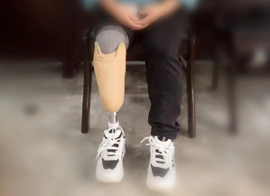 【保山安利醫(yī)院】全國助殘日我們?cè)谛袆?dòng)——為51名殘疾患者行假肢維修安裝及康復(fù)指導(dǎo)服務(wù)