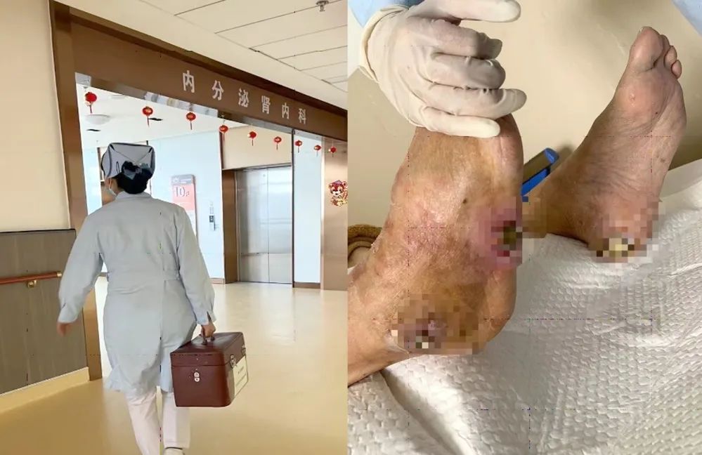 【保山安利醫(yī)院】傷口治療一站式，健康生活零距離！